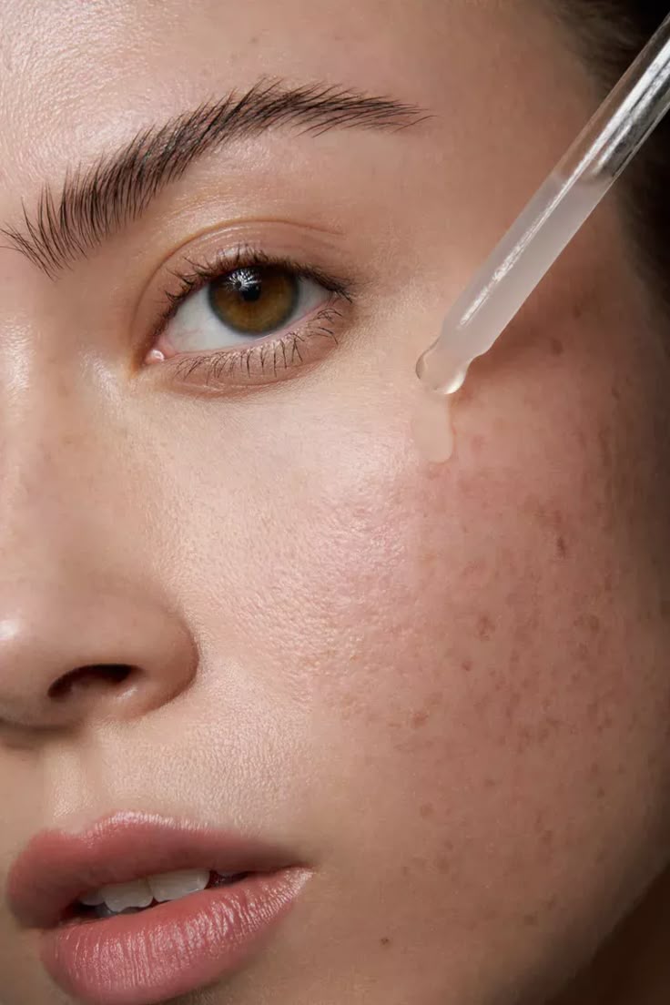 Acne & Oil Control